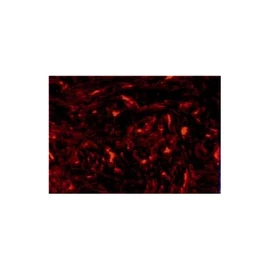 GG-S - Öntapadós teknős páncél mintás koptató lap